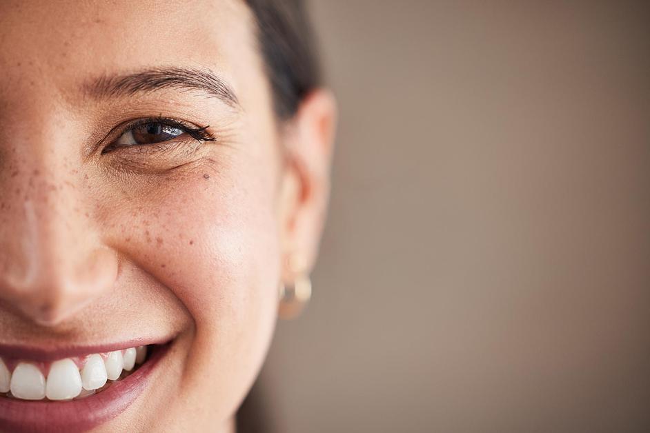 Close-up of bright smile and healthy skin with natural freckles and clear, expressive eye